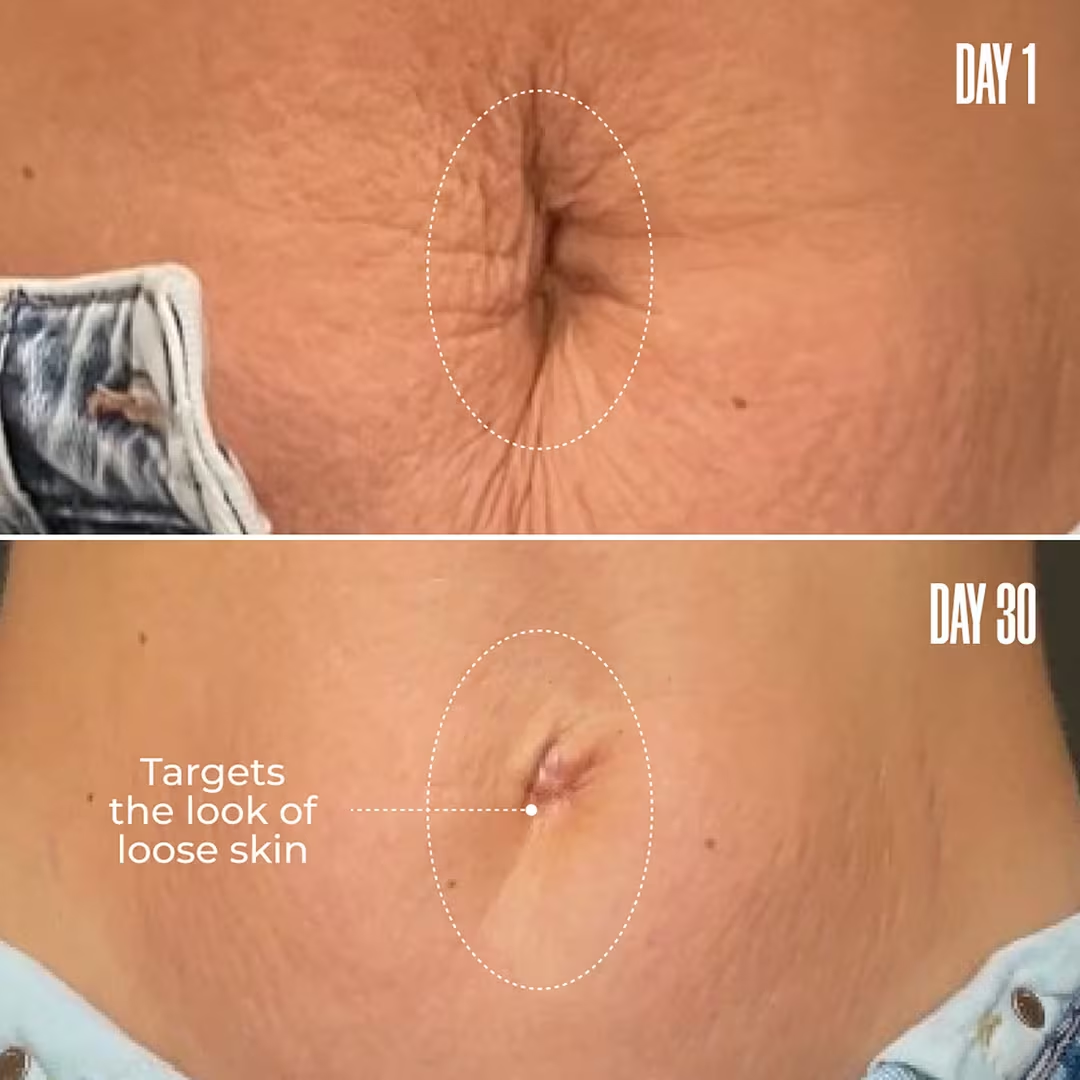 Final 3 Hours: 60% OFF 🔥B-FLAT Belly Firming Cream