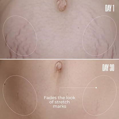 Final 3 Hours: 60% OFF 🔥B-FLAT Belly Firming Cream